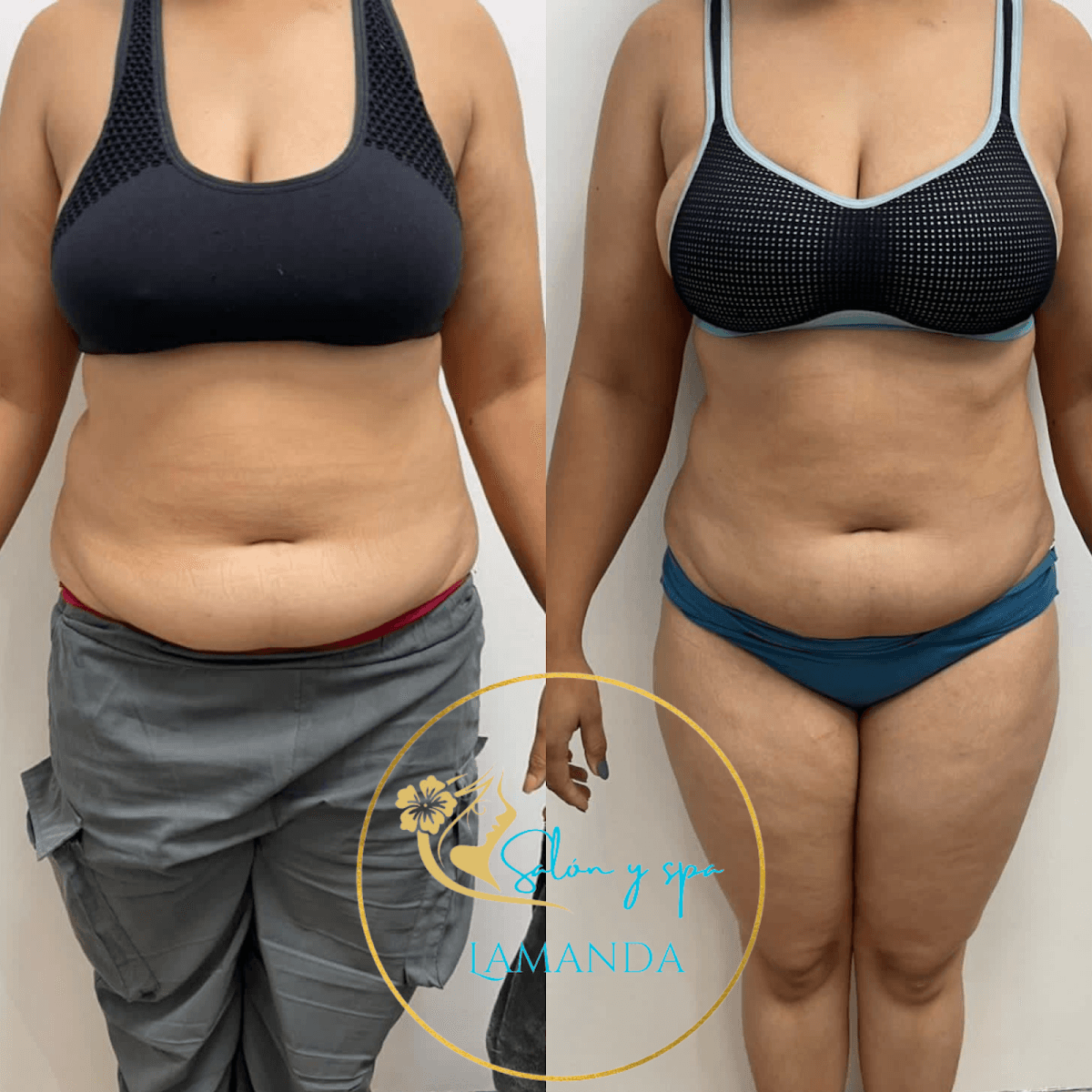 Lamanda Bávaro - Imagen 2
